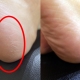 Before & After比較。有保養的腳底,秋冬才不會穿絲襪常勾紗、粗糙刮/勾被,或是磨痛男朋友的皮膚唷。