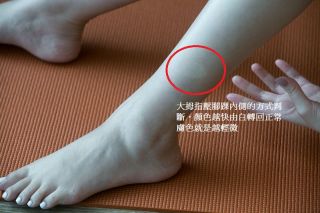 如何簡單判斷是否水腫?水腫程度?以下幾個指標提供給大家居家檢測。1.利用大拇指按壓腳踝內側,顏色由白轉回正常膚色較緩慢。2.爬樓梯時覺得腿部沉重無力。3.中午過後小腿變粗,感覺酸、脹、腫。如果有以上3種情形,就是有水腫的初期症狀,水腫的程度,可以用大拇指壓腳踝內側的方式判斷,顏色越快由白轉回正常膚色就是越輕微,越慢甚至有凹陷不會回彈的情形就是越嚴重。