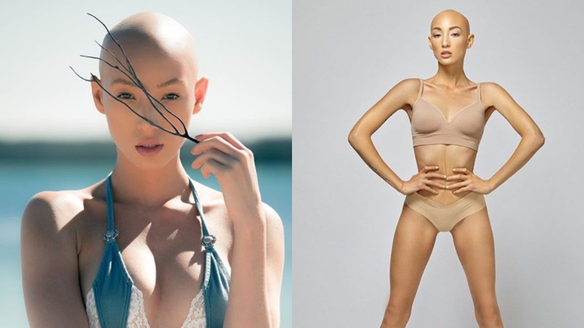 罹患全頭禿，《超級名模生死鬥》24季女模Jeana Turner：「光頭也能一樣美麗。