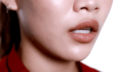 Photo/丰采美學牙醫診所 Photo/丰采美學牙醫診所